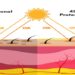 Protecting Your Skin from Cancer Causing Ultraviolet Radiation